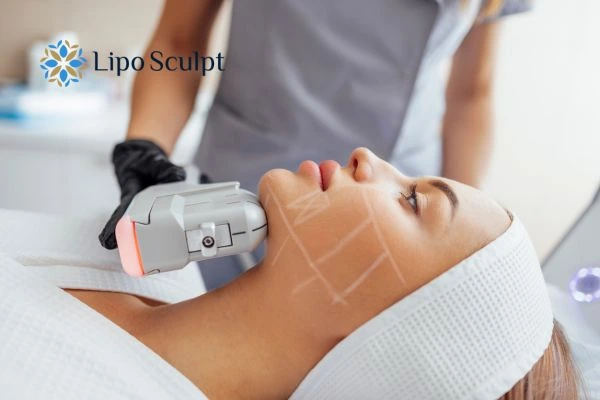 HIFU vs Botulinum Toxin: Understanding the Differences 1 HIFU vs Botox Gainsborough What is the best option for you?