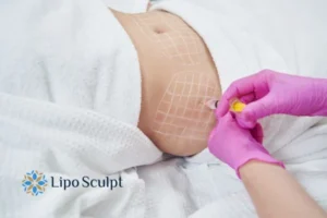 Are The Results From Aqualyx Permanent? 1 Do you want to know how long Aqualyx Gainsborough results last?