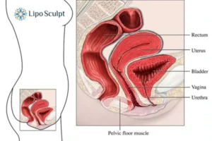 Treatment For A Leaky Bladder 2 How EM Chair treatment Gainsborough can help Leaky bladder issues. Read more now!