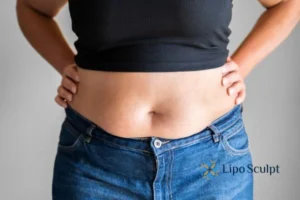 Bidding Farewell to Muffin Tops with Aqualyx Fat Injections 2 Do you wish you could reduce your muffin top Gainsborough With Aqualy fat dissolving injections you can!