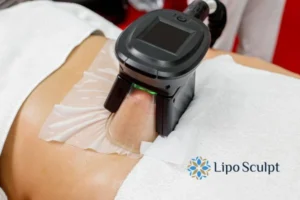 Does Fat Freezing At Home Work? 3 Fat freezing at home from Lipo Sculpt Gainsborough